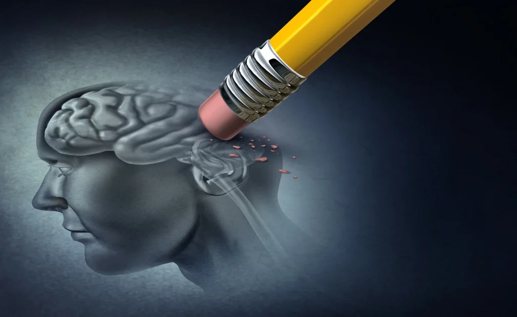 Alzheimer's